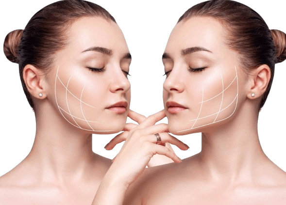 Booster Hydro Plus para piel Booster hydronplus para piel angeluscr clinica medicina estetica costa rica003