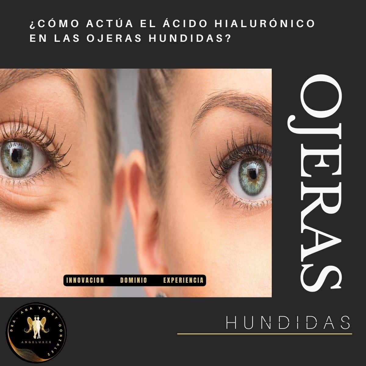 Blog angeluscr Clinica Medicina Estetica en Costa Rica 2